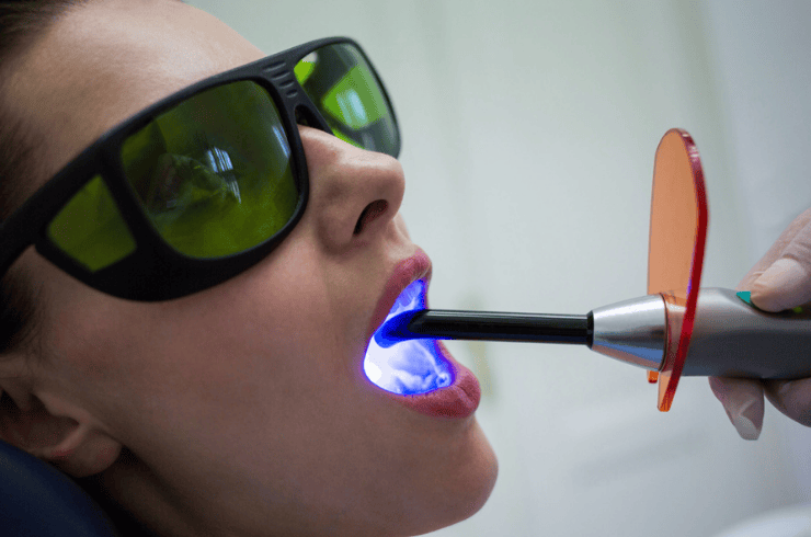 Laser Dentistry